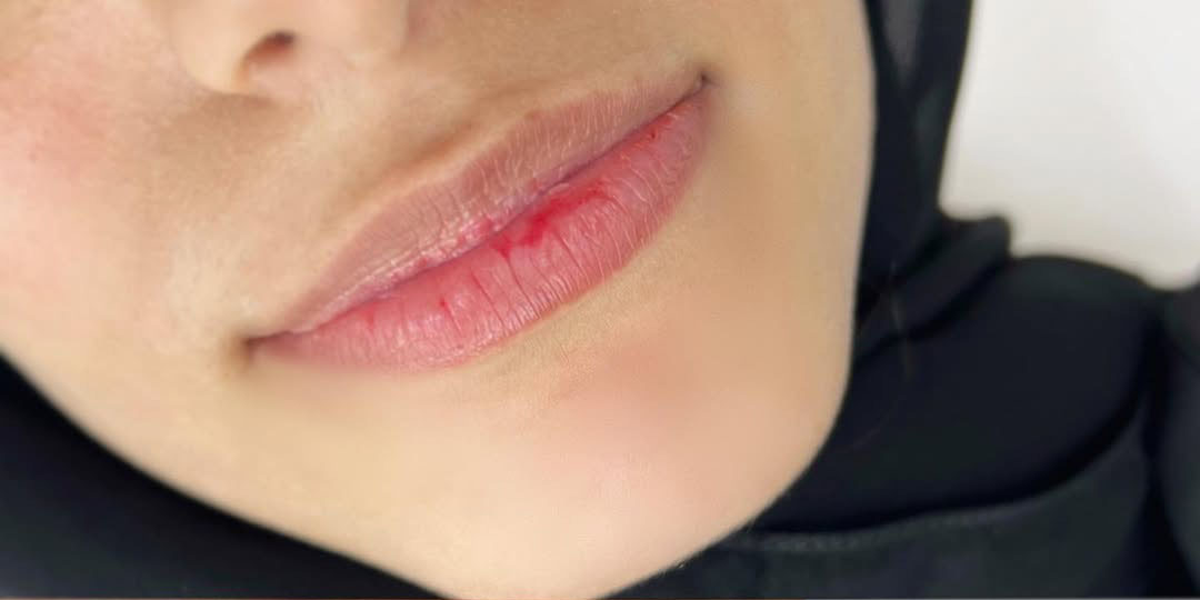 صورة قبل النتيجة